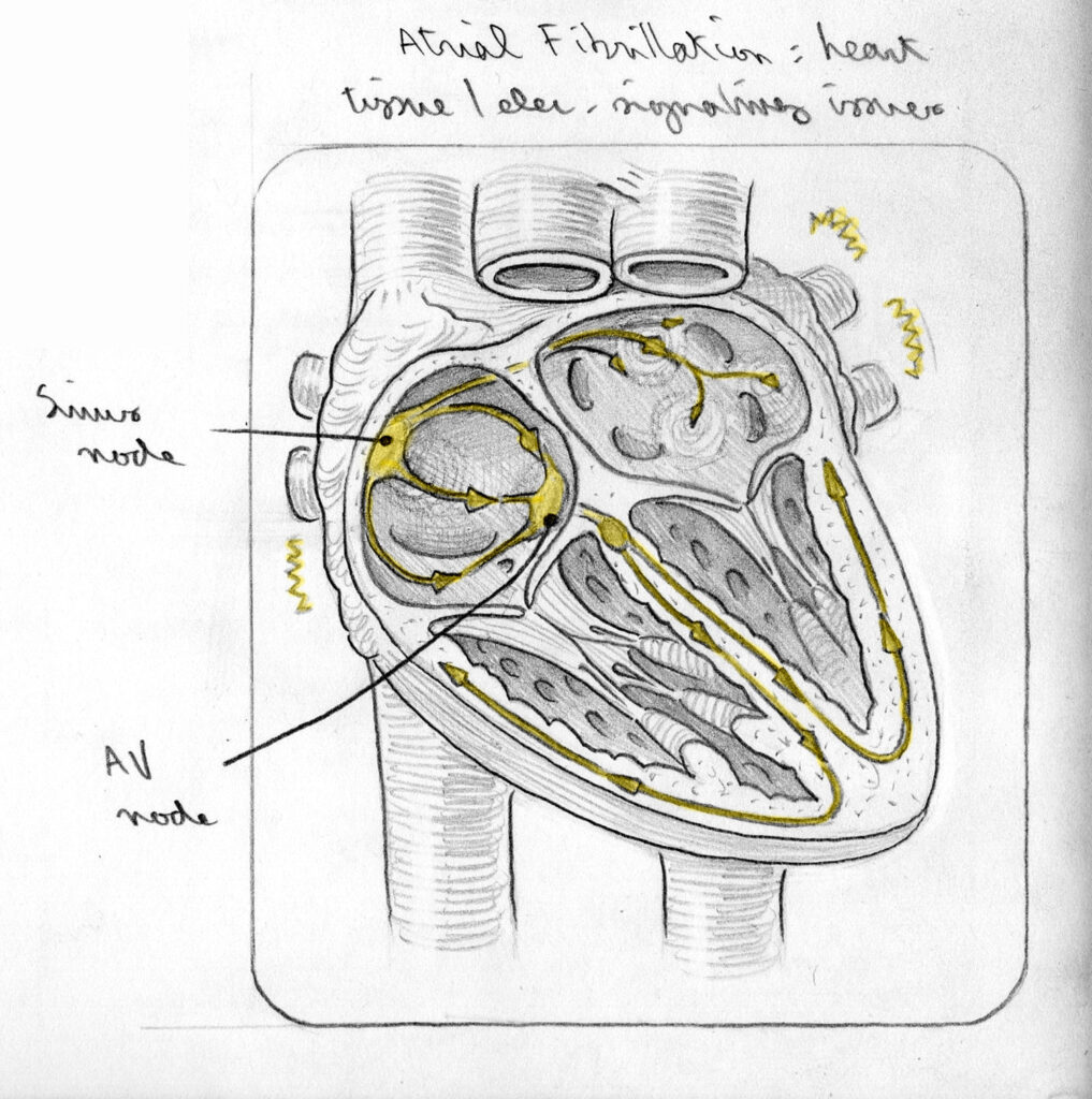 PFA sketch 2